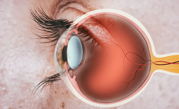 Akshay Netra - Eye Image
